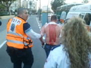 بالصور: إصابة شاب اثر تعرضه لعملية طعن في شارع شديروت يروشلايم بيافا 